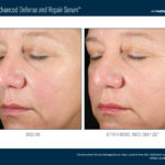 Alto Advanced Defense and Repair Serum Before and After 1