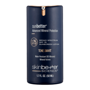 Skinbetter TONE SMART SPF75 Lotion 1.7fl oz